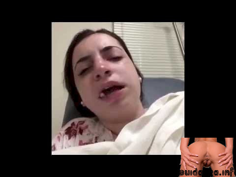 surgery dick white girl deep throats black cock
